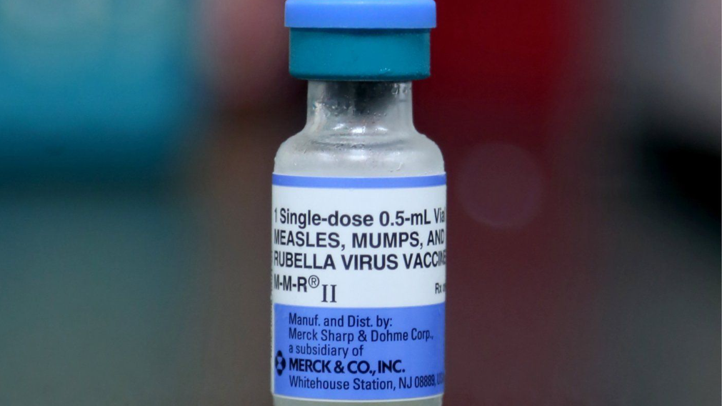 Are you fully immunized against measles? Canada's public health agency says to check