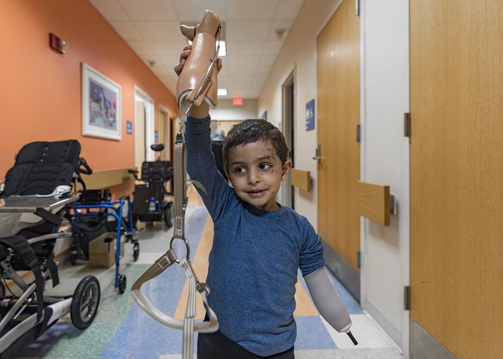 A 4-year-old Gaza boy lost his arm – and his family. Half a world